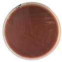 Interlab, Graso Biotech, 1320