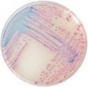 Interlab, Graso Biotech, 1320