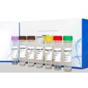 Interlab, SARS-CoV-2-RT-PCR