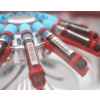 Kategorijos Hematologija image